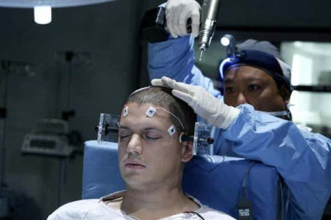 Michael gets 'experimental' surgery from The Company in 'Prison Break' Season 4. 