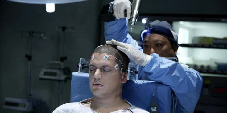 Michael gets 'experimental' surgery from The Company in 'Prison Break' Season 4. 