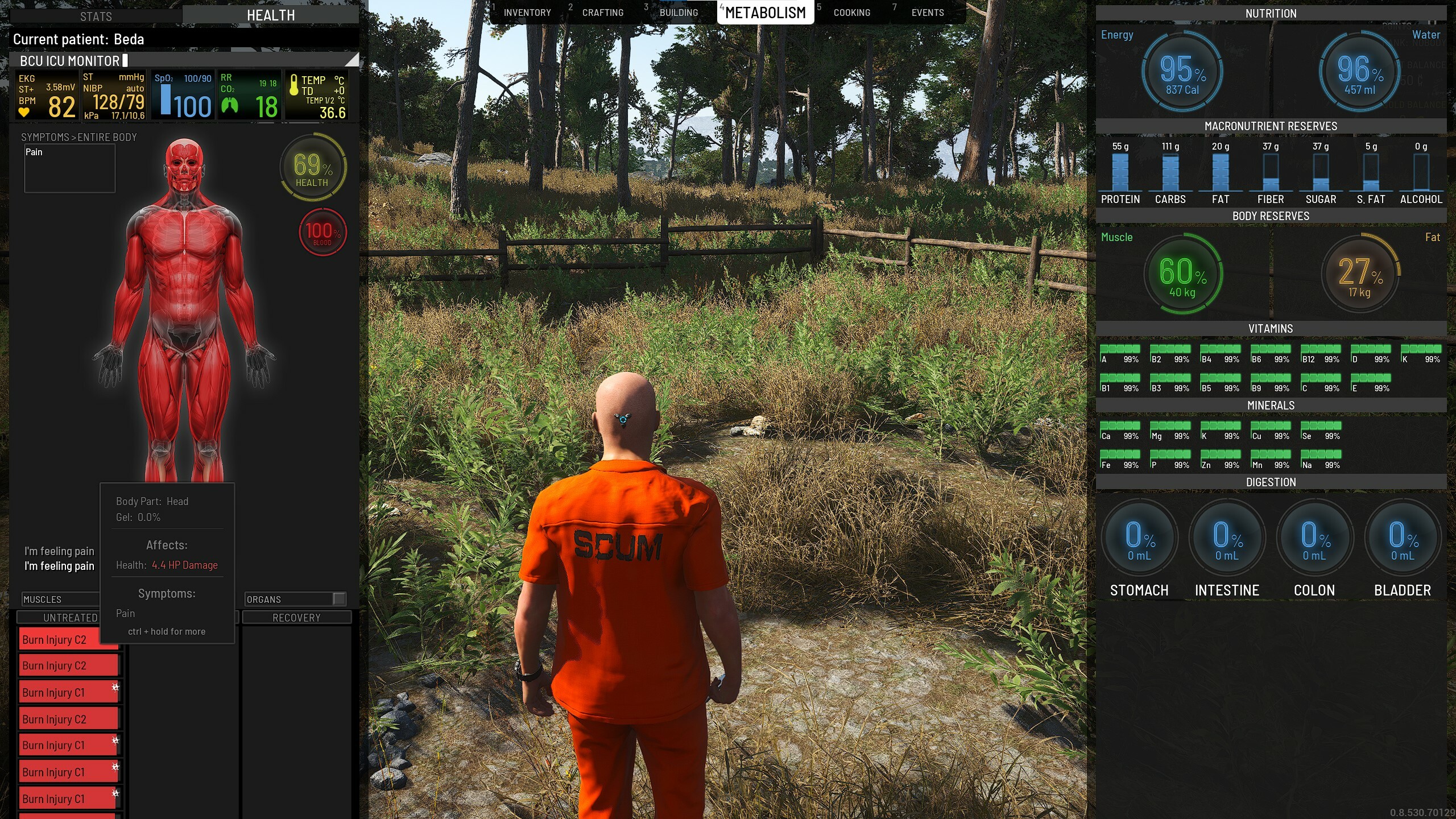 SCUM: Latest Content Patch Introduced Burn Damage and More