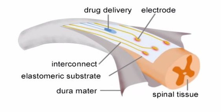 The 'e-Dura' implant mimics the soft tissue around the spine in it's flexibility and the way it delivers electrical charges and chemicals needed for walking.