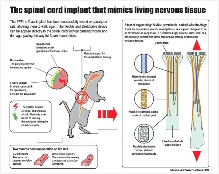 Paralyzed rats on whom the e-Dura implant was tested, regained their ability to walk on their own again after a few weeks of training. and could "sprint over ground, climb stairs and even pass obstacles".